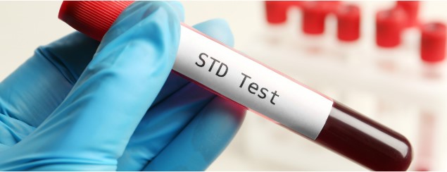 test tube with blood labeled STD